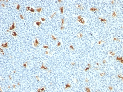 Formalin-fixed, paraffin embedded human tonsil sections stained with 100 ul anti-S100A9 (clone S100A9/1011) at 1:300. HIER epitope retrieval prior to staining was performed in 10mM Citrate, pH 6.0.